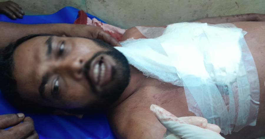 গুরুতর আহত ইকবাল 