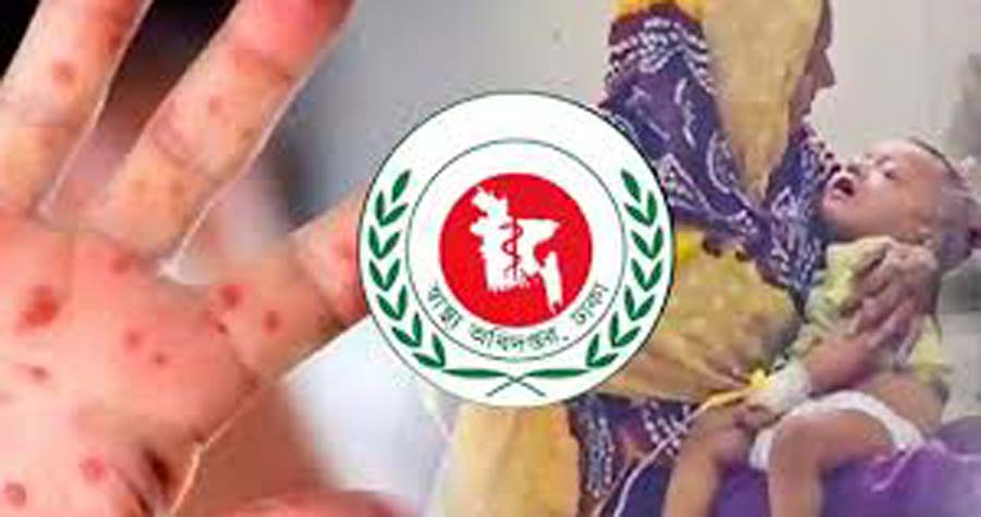 হাম ও উপসর্গে আরো ১০ শিশুর মৃত্যু