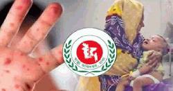 হাম ও হামের উপসর্গ নিয়ে একদিনে ৫ শিশুর মৃত্যু